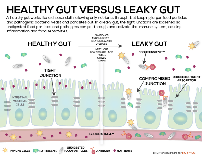 HealthyLeakyGut