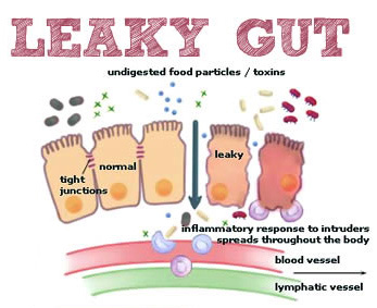 leaky-gut - Core Health Products